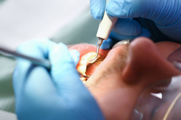 Best Pediatric Emergency Dentist in Catoosa, OK